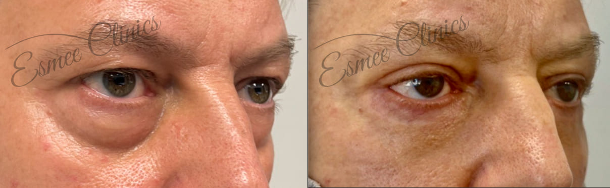 Before and After img